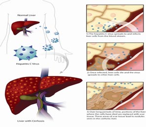 liver